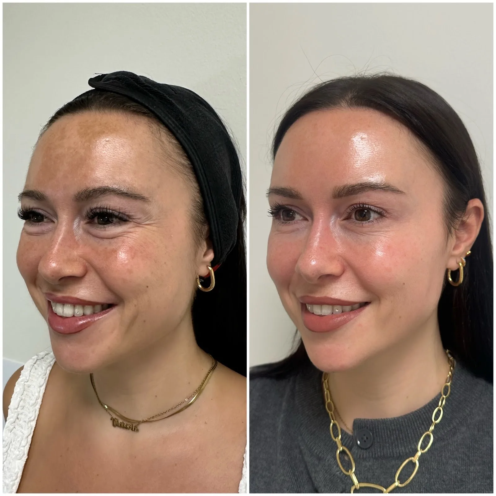 Clinica estetica Beauty Skin Barcelona en Barcelona