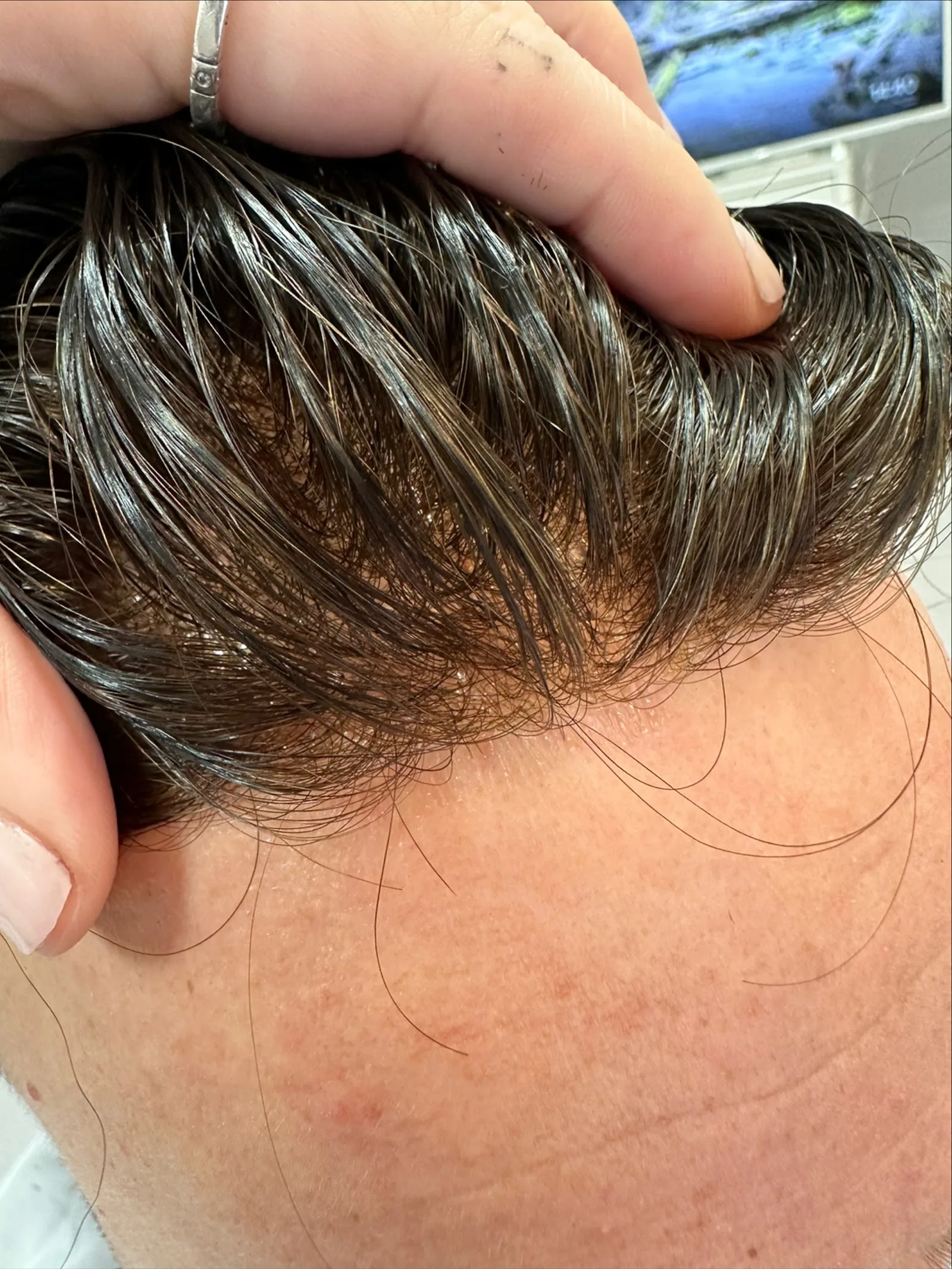 Clinica estetica Bliss Capilar Center en Barcelona