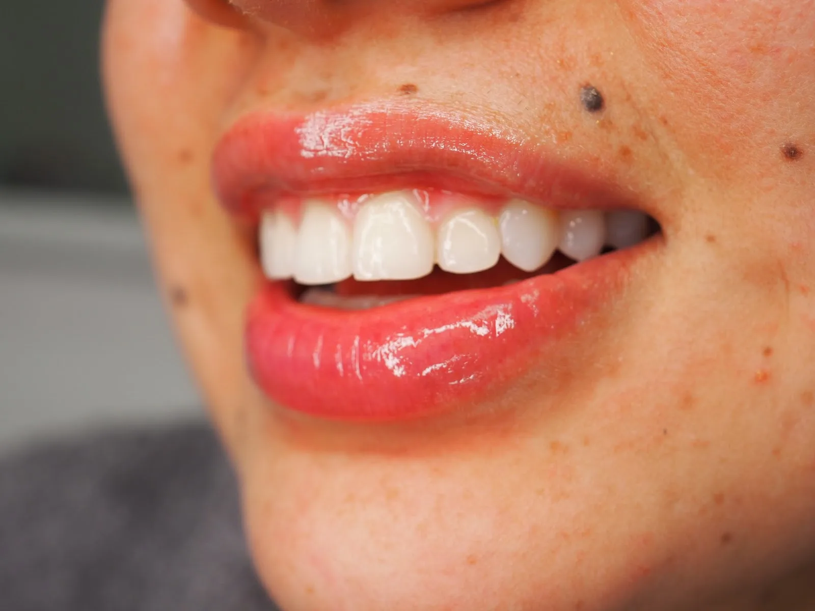 Clinica estetica Ckath Estudio - Centro de Estética Facial en Barcelona