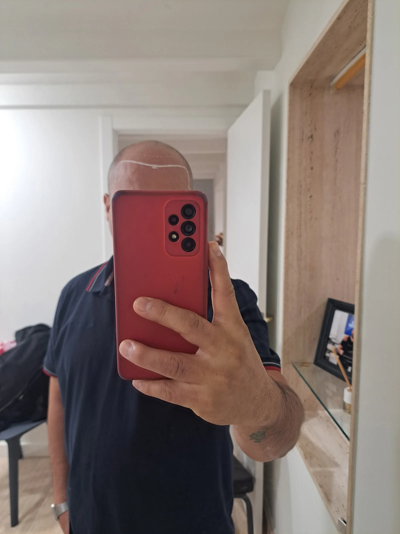 Clinica estetica Clínica Renace | Trasplante y Micropigmentación Capilar en Barcelona