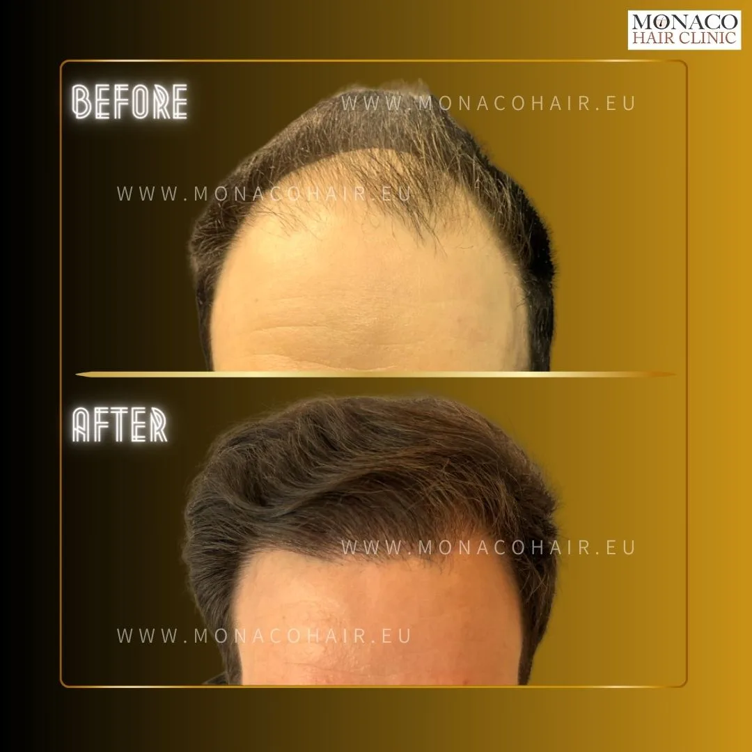 Clinica estetica VM Clinics - Clínica de Cirugía Estética en Barcelona en Barcelona